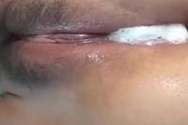 漂亮美眉 被无套输出 小娇乳哗哗 骚叫不停 内射一鲍鱼 一线天都有点肿了